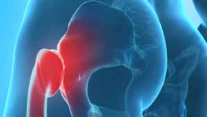 कूल्हे की हड्डी