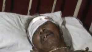 भालू के हमले से घायल वृद्ध